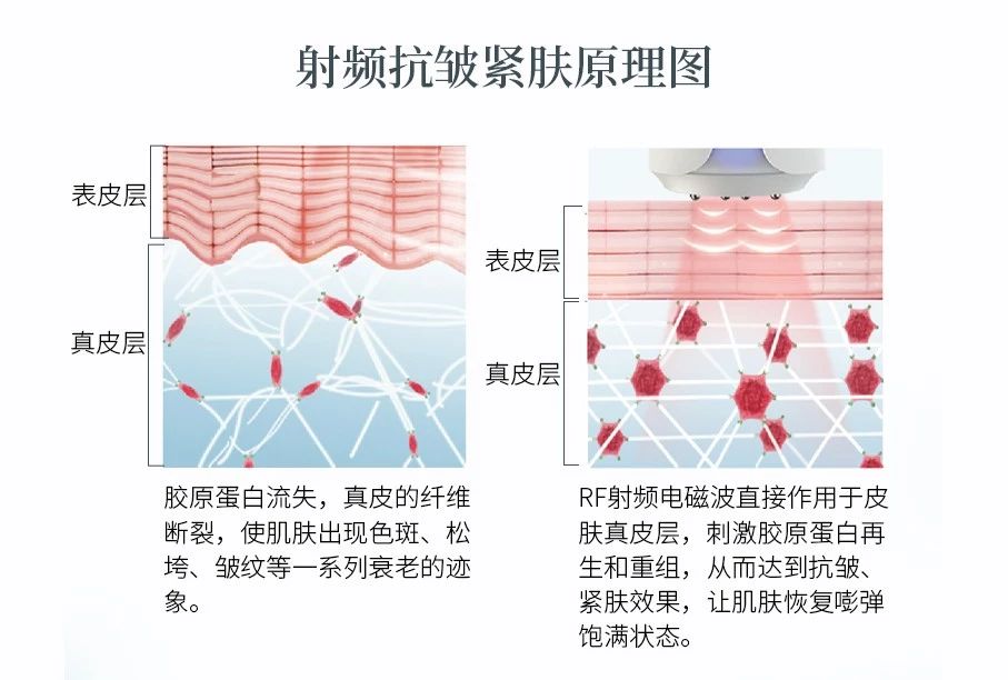 美容仪